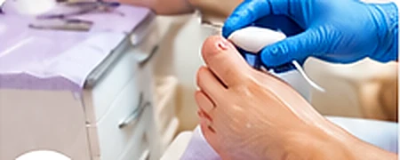 Zorgvuldige medisch-pedicurebehandeling